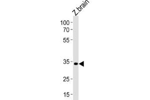 Western Blotting (WB) image for anti-Paired Box Gene 2a (PAX2A) antibody (ABIN3004629)