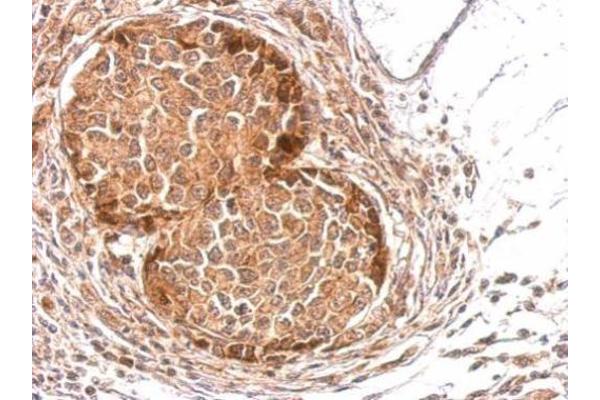 SLA antibody