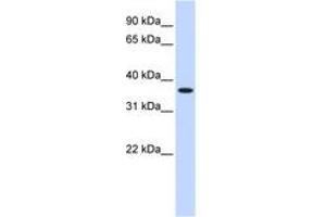Image no. 1 for anti-Zinc Finger Protein 444 (ZNF444) (AA 108-157) antibody (ABIN6740452) (ZNF444 antibody  (AA 108-157))