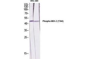 Western Blot (WB) analysis of specific cells using Phospho-MEK-2 (T394) Polyclonal Antibody. (MEK2 antibody  (pThr394))