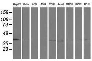 Image no. 2 for anti-Alcohol Dehydrogenase 1B (Class I), beta Polypeptide (ADH1B) antibody (ABIN1496477) (ADH1B antibody)