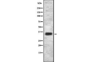 Western blot analysis OR2L2 using HepG2 whole cell lysates (OR2L2 antibody)
