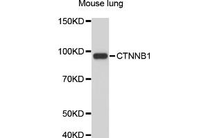 Western blot analysis of extracts of mouse lung, using CTNNB1 antibody (ABIN4903405).