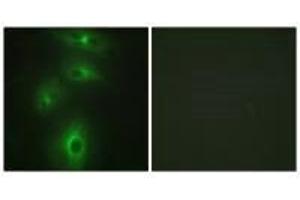 Immunofluorescence analysis of HeLa cells, using TMPRSS3 antibody. (TMPRSS3 antibody  (C-Term))
