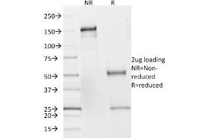 SDS-PAGE Analysis of Purified SDHB Mouse Monoclonal Antibody (SDHB/2382). (SDHB antibody  (AA 165-273))