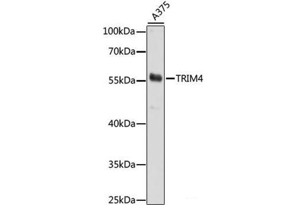 TRIM4 抗体