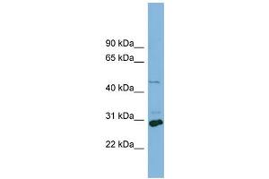 WB Suggested Anti-SLC16A1  Antibody Titration: 0. (SLC16A1 antibody  (Middle Region))