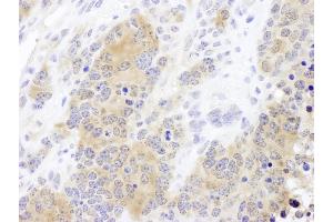 Immunohistochemistry (IHC) image for anti-Chaperonin Containing TCP1, Subunit 2 (Beta) (CCT2) (AA 325-375) antibody (ABIN7453613) (CCT2 antibody  (AA 325-375))