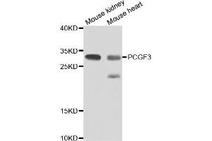 Western blot analysis of extracts of various cell lines, using PCGF3 antibody (ABIN4904703) at 1:1000 dilution. (PCGF3 antibody)