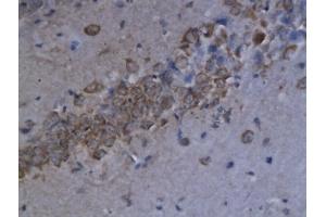 Formalin-fixed and paraffin embedded mouse brain labeled with Anti-CXCL9/MIG Polyclonal Antibody, Unconjugated (ABIN741930) followed by conjugation to the secondary antibody and DAB