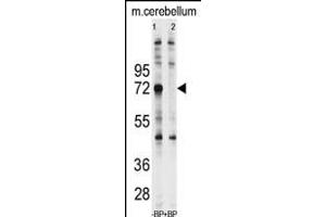 Western blot analysis of anti-Ubiquilin1 Antibody (N-term) (ABIN388965 and ABIN2837880) pre-incubated with and without blocking peptide (BP2176a) in Jurkat cell line lysate.
