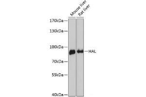 Western blot analysis of extracts of various cell lines using HAL Polyclonal Antibody at dilution of 1:3000. (HAL antibody)