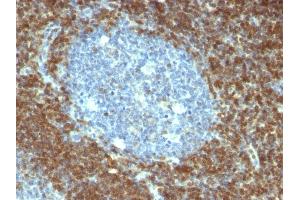 Formalin-fixed, paraffin-embedded human Tonsil stained with Bcl-2 Mouse Monoclonal Antibody (BCL2/796). (Bcl-2 antibody)