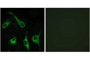 Immunofluorescence analysis of COS7 cells, using EDG1 Antibody. (S1PR1 antibody  (AA 5-54))