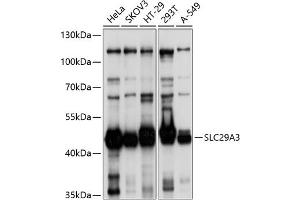 Western blot analysis of extracts of various cell lines, using SLC29 antibody (ABIN6132901, ABIN6147951, ABIN6147952 and ABIN6214611) at 1:1000 dilution. (SLC29A3 antibody  (AA 1-110))