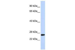 SETD4 antibody used at 0. (SETD4 antibody  (C-Term))