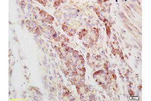 Formalin-fixed and paraffin embedded mouse embryo labeled with Rabbit Anti AXL/UFO Polyclonal Antibody, Unconjugated (ABIN756022) at 1:200 followed by conjugation to the secondary antibody and DAB staining (AXL antibody  (AA 151-250))