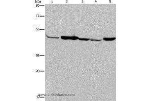 Western blot analysis of Human fetal muscle tissue, Jurkat and 293T cell, Hela cell and mouse liver tissue, using IDH2 Polyclonal Antibody at dilution of 1:600 (IDH2 antibody)