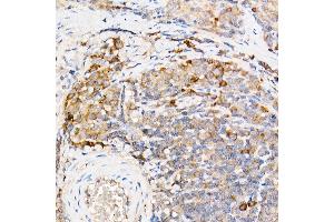 Immunohistochemistry (IHC) image for anti-Interferon alpha/beta Receptor 1 (IFNAR1) (AA 470-557) antibody (ABIN7267947)