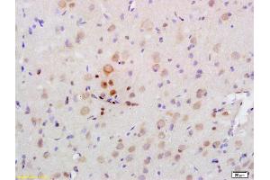 Formalin-fixed and paraffin embedded rat brain labeled with Rabbit Anti PRKAA2/AMPK alpha 2 Polyclonal Antibody, Unconjugated (ABIN680458) at 1:200 followed by conjugation to the secondary antibody and DAB staining (PRKAA2 antibody  (AA 351-450))