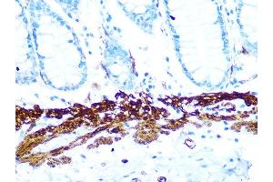 Immunohistochemistry (IHC) image for anti-Protein Kinase, AMP-Activated, beta 1 Non-Catalytic Subunit (PRKAB1) antibody (ABIN7269654)