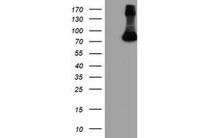 HEK293T cells were transfected with the pCMV6-ENTRY control (Left lane) or pCMV6-ENTRY FBXO21 (Right lane) cDNA for 48 hrs and lysed. (FBXO21 antibody)