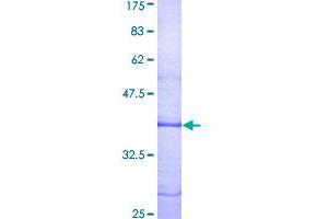 LPAR1 Protein (AA 1-125) (GST tag)