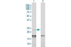 Western Blot analysis of EDN1 expression in transfected 293T cell line by EDN1 monoclonal antibody (M01), clone 3D6.