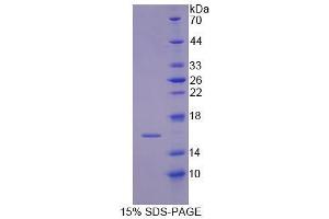 SDS-PAGE (SDS) image for Insulin Receptor Substrate 4 (IRS4) (AA 1-299) protein (His tag) (ABIN4990092)