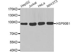 Western blot analysis of extracts of various cell lines, using HSP90B1 antibody (ABIN2968872). (GRP94 antibody)