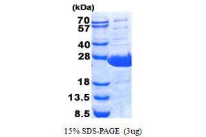 Image no. 1 for BPI Fold Containing Family A, Member 1 (BPIFA1) protein (His tag) (ABIN1098511) (BPIFA1 Protein (His tag))