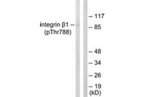 Western blot analysis of extracts from HeLa cells treated with UV 15', using Integrin beta1 (Phospho-Thr788) Antibody. (ITGB1 antibody  (pThr788))