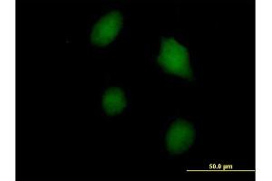 Immunofluorescence of purified MaxPab antibody to LGALS3 on HeLa cell. (Galectin 3 antibody  (AA 1-250))