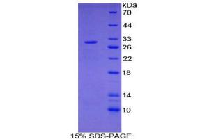 SDS-PAGE (SDS) image for Nucleoporin 107kDa (NUP107) (AA 554-784) protein (His tag) (ABIN2126136)