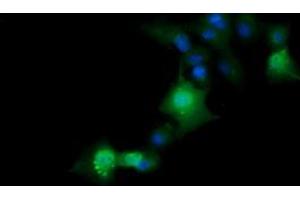 Image no. 6 for anti-ERG, ETS transcription factor (ERG) antibody (ABIN1498079) (ERG antibody)