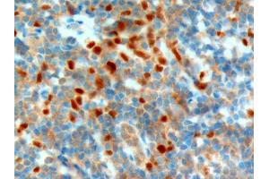 ABIN185112 (1µg/ml) staining of paraffin embedded Human Tonsil. (NET1 antibody  (C-Term))
