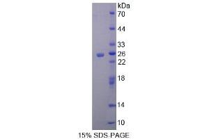 SDS-PAGE analysis of Rat MTX1 Protein. (Metaxin 1 Protein (MTX1))