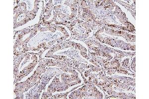 IHC analysis of TOP2A using anti-TOP2A antibody (ABIN7602988).