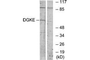 Western blot analysis of extracts from K562 cells, using DGKE Antibody. (DGKE antibody  (AA 161-210))