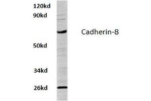 Image no. 1 for anti-Cadherin 8 (CDH8) antibody (ABIN317620)