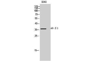 Western Blotting (WB) image for anti-Adrenergic, beta-3-, Receptor (ADRB3) (Internal Region) antibody (ABIN3183396) (ADRB3 antibody  (Internal Region))