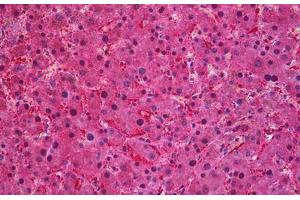 Human Liver: Formalin-Fixed, Paraffin-Embedded (FFPE) (SEC61A1 antibody  (AA 463-476))