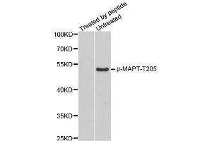 Western blot analysis of extracts from mouse brain tissue, using phospho-MAPT-T205 antibody (ABIN2987497). (MAPT antibody  (pThr205))