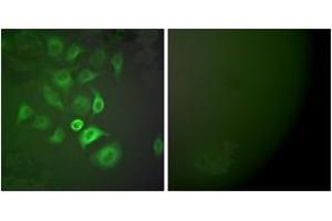 Immunofluorescence analysis of A549 cells, using S100 A1 Antibody. (S100A1 antibody  (AA 10-59))