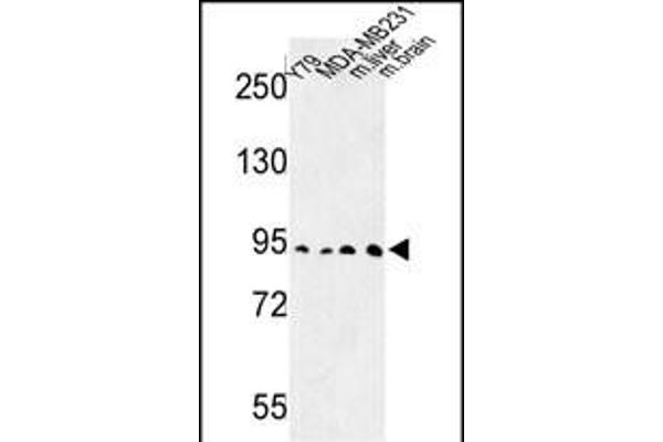 DPP10 Antikörper  (AA 150-177)