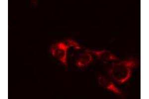 ABIN6274443 staining COLO205 cells by IF/ICC.