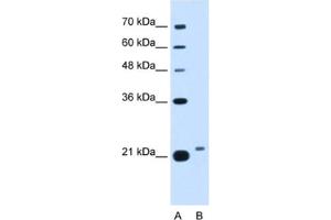 Western Blotting (WB) image for anti-LOC400856 (LOC400856) antibody (ABIN2462913) (LOC400856 antibody)