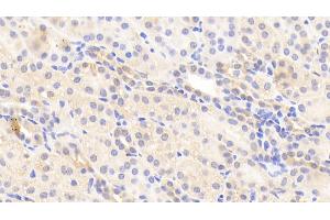 Immunohistochemistry (IHC) image for anti-Apolipoprotein H (Beta-2-Glycoprotein I) (APOH) (AA 22-345) antibody (ABIN7431611)