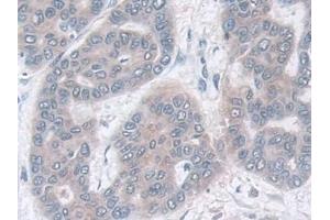 Immunohistochemistry (IHC) image for anti-Isocitrate Dehydrogenase 2 (NADP+), Mitochondrial (IDH2) (AA 40-452) antibody (ABIN7441520)