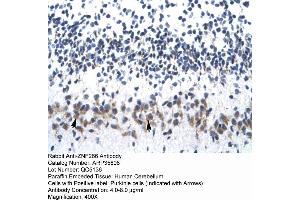 Human Cerebellum (ZNF266 antibody  (N-Term))